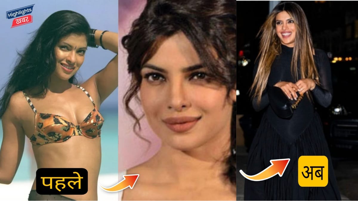 fans-trolled-priyanka-chopra-for-face-surgery