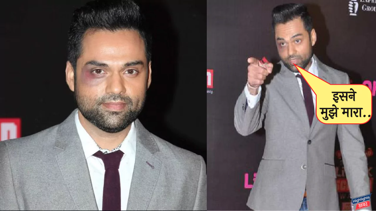 abhay-deol-accused-t-series-of-assault