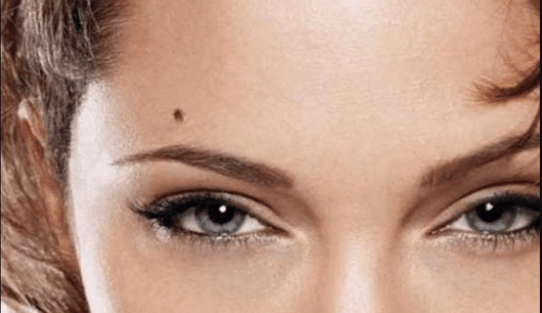 know what is the meaning of mole on these special body parts of women